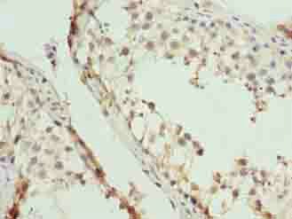 EIF5A2 Antibody