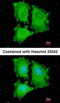 EIF5A2 antibody