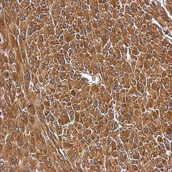 EIF5A2 antibody