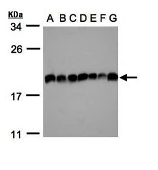 EIF5A2 antibody
