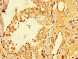 ELAC1 Antibody
