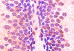 ELAVL2 Antibody