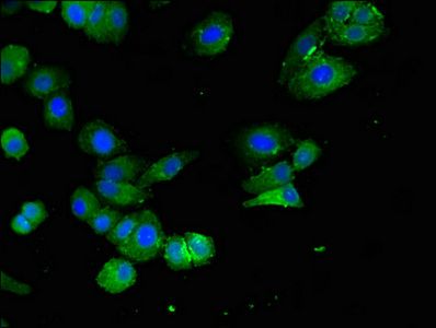 ELOVL4 Antibody