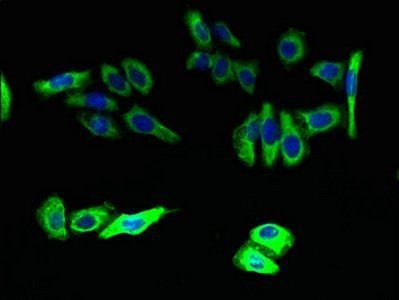 ELOVL5 Antibody