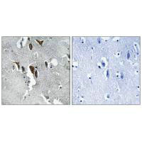 ELOVL5 Antibody