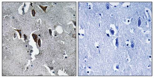 ELOVL5 Antibody