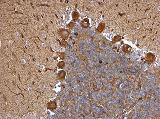 EML1 antibody [C3], C-term