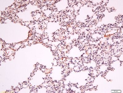Endothelial lipase Rabbit Polyclonal Antibody