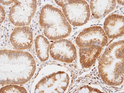 ENO1 antibody [N3C3]