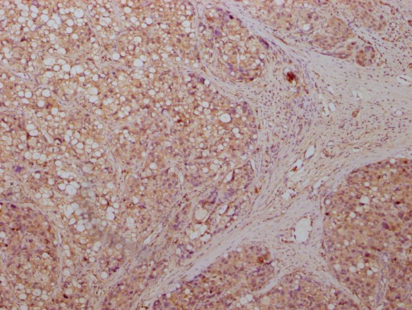 ENO1 Monoclonal Antibody