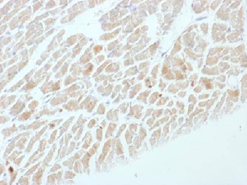 NSE gamma (Neuron Specific Enolase, gamma) (Neuroendocrine Marker) Antibody