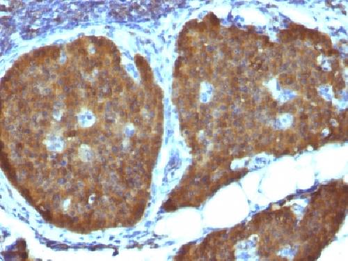 NSE gamma (Neuron Specific Enolase, gamma) (Neuroendocrine Marker) Antibody