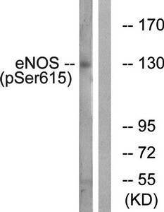 eNOS (Phospho-Ser615) Antibody