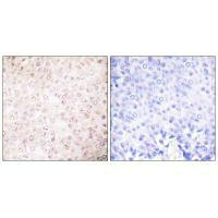 EP300/CREBBP Antibody