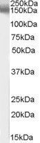 EPB41L3/DAL1 Antibody