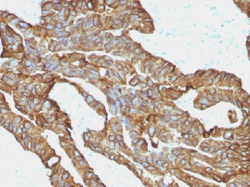 Ep-CAM / CD326 (Extracellular Domain) (Epithelial Marker) Antibody