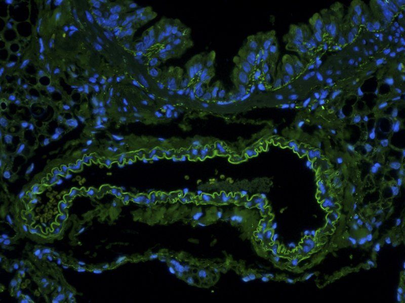 EpCAM antibody (FITC)