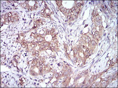 EPCAM