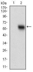 EPCAM