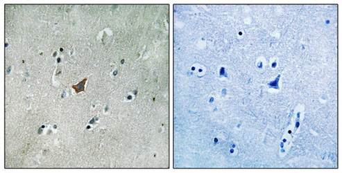EPHA3/4/5 (Phospho-Tyr779/833) Antibody