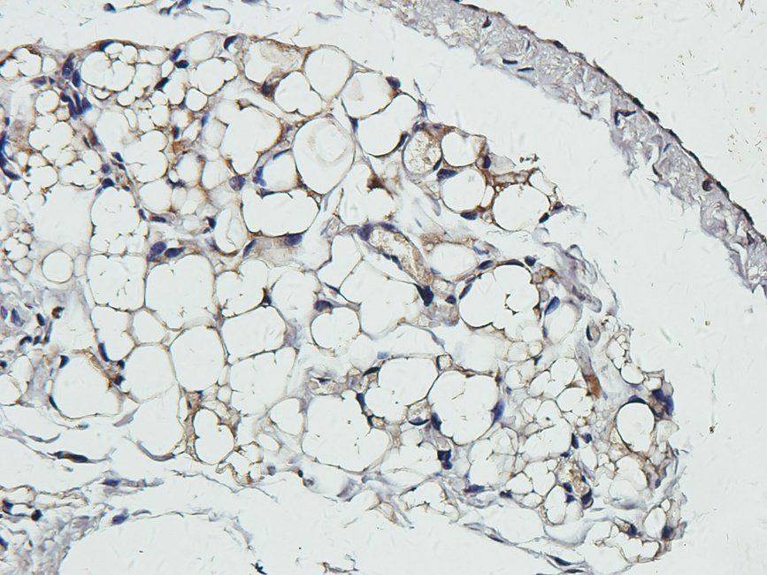 EPHA4 antibody
