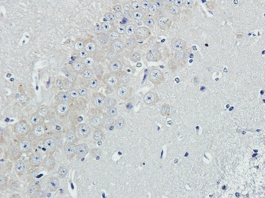 EPHA4 antibody