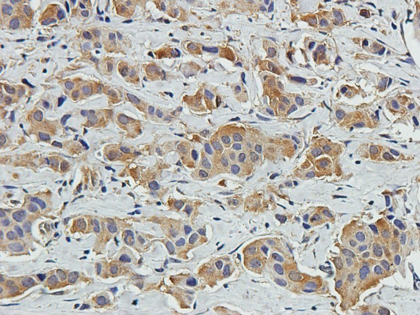 EPHA4 antibody