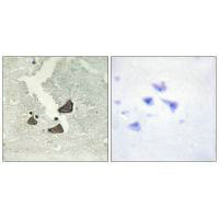 EPHB6 Antibody