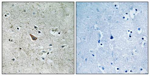 Ephrin B1/B2 (Phospho-Tyr329) Antibody