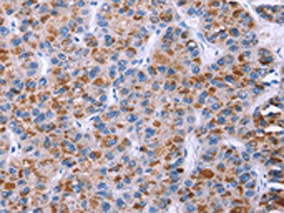 ESPL1 Antibody