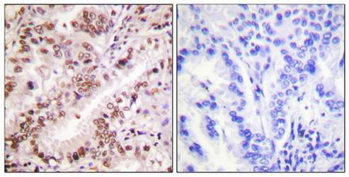 Estrogen Receptor-α (Phospho-Tyr537) Antibody