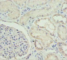 ETFA Antibody