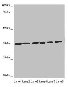 ETFA Antibody