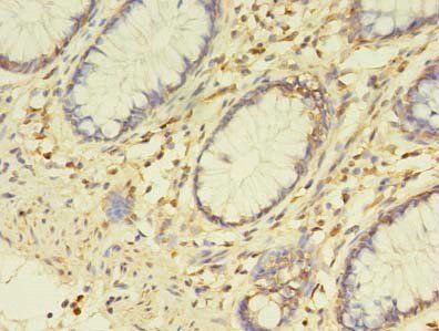 ETHE1 Antibody