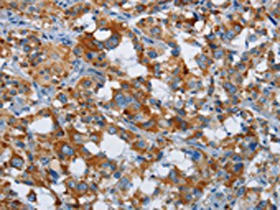 ETHE1 Antibody