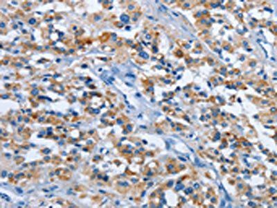 ETHE1 Antibody