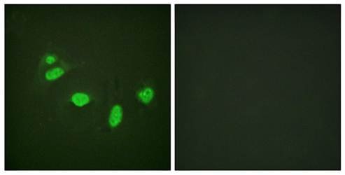ETS1 (Phospho-Thr38) Antibody