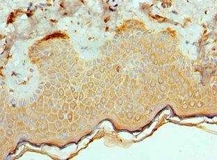 ETV6 Antibody