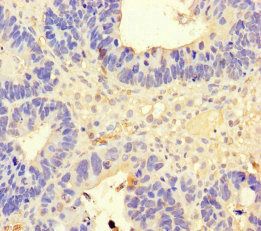 EIF4A2 Antibody