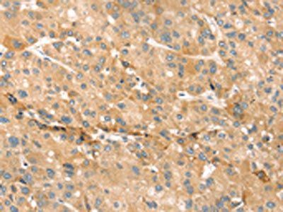 EVA1A Antibody