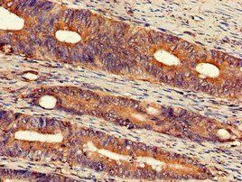 EXT2 Antibody
