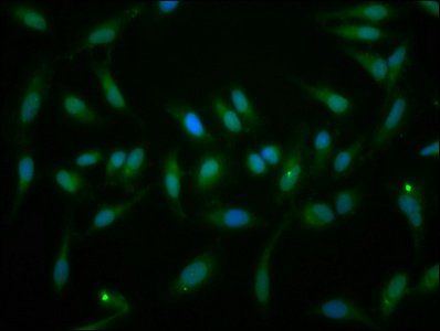 EYA1 Antibody