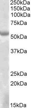 EYA1 Antibody