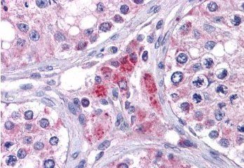 EYA4 Antibody