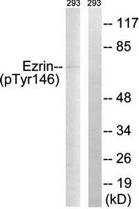 Ezrin (Phospho-Tyr146) Antibody