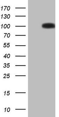 Glucocorticoid Receptor Antibody