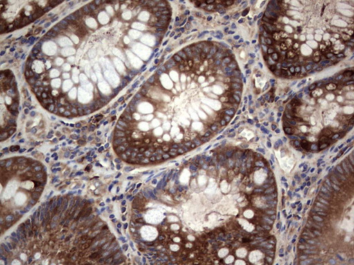 GARS1 Antibody