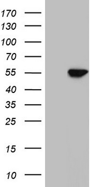 LXR alpha Antibody
