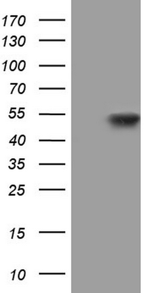 NIPP1 Antibody