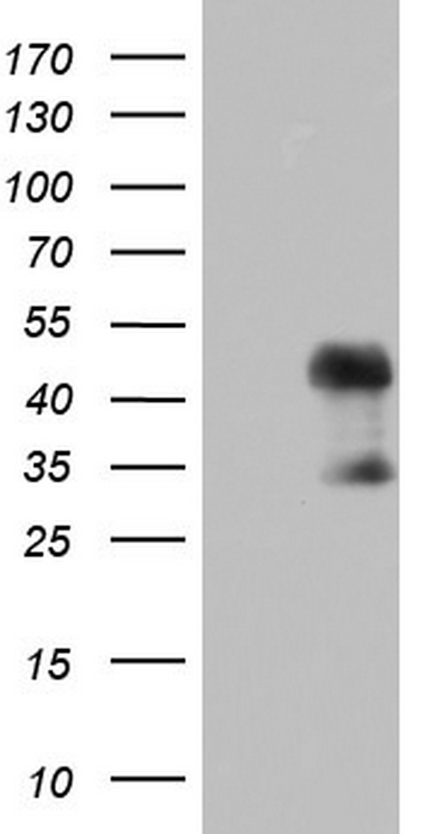 Fos B Antibody